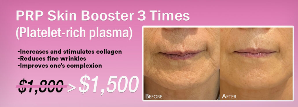 PRP Skin Booster 3 Times $1,500
